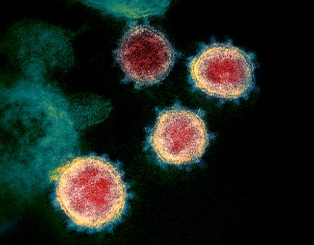 One Case Of Omicron COVID Variant Found In West Virginia